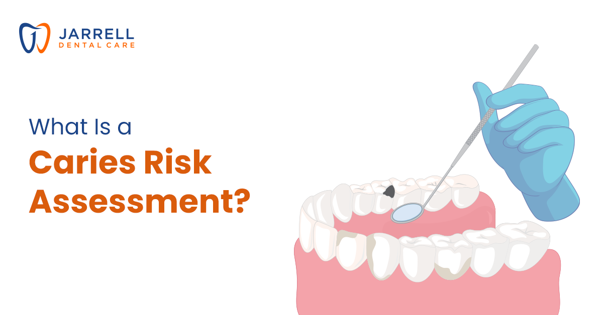 What Is a Caries Risk Assessment?
