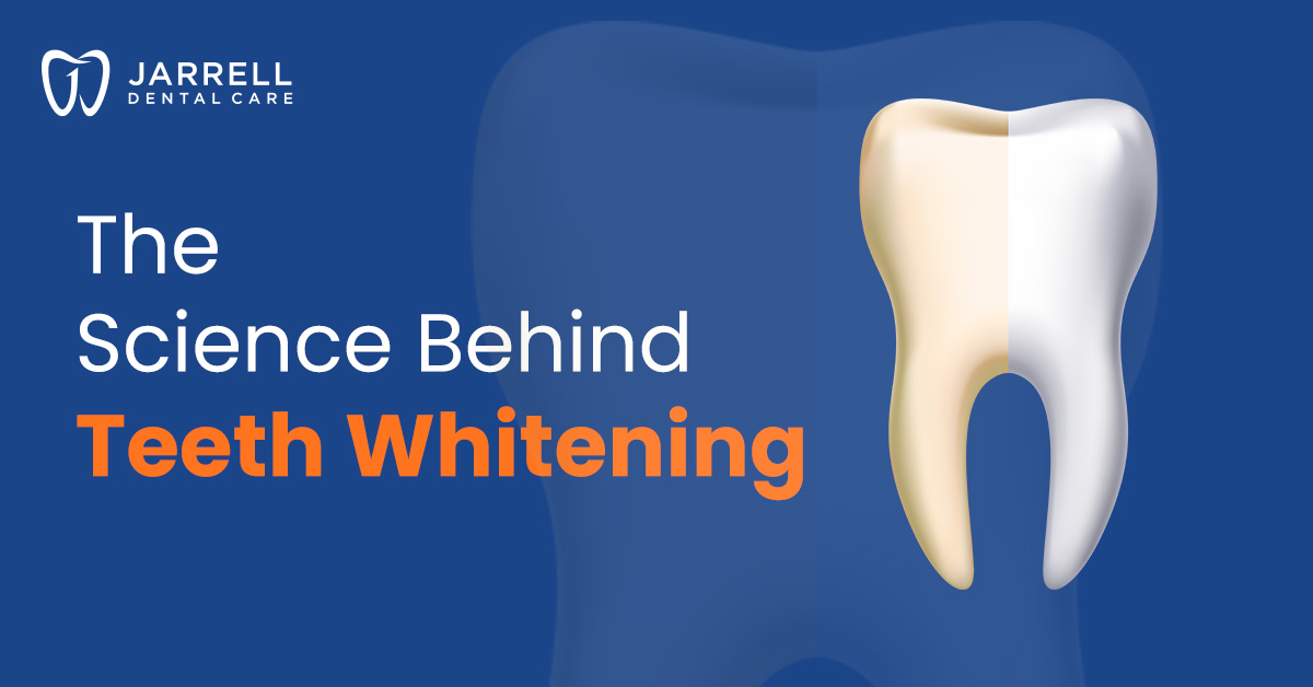 The Science Behind Teeth Whitening