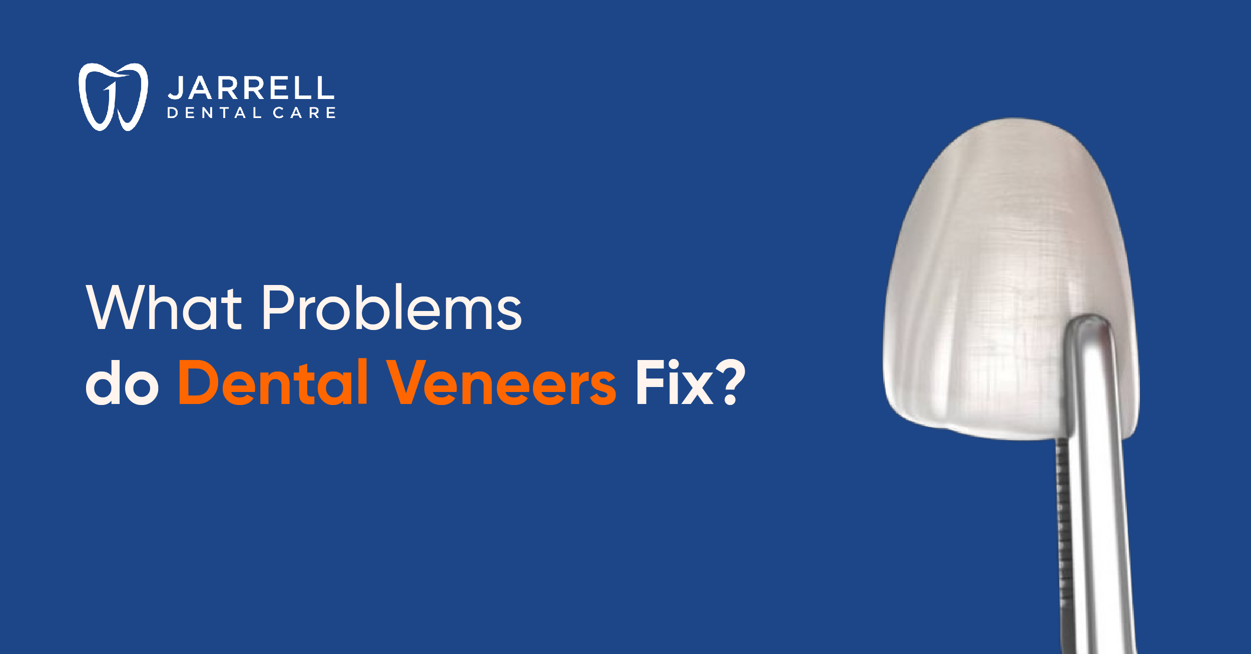 What Problems do Dental Veneers Fix?